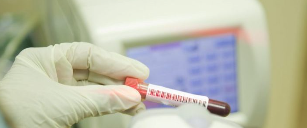 Inspecting a blood sample 